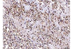 IHC analysis of Cdk2 using anti-Cdk2 antibody (ABIN7602523). (CDK2 antibody  (AA 81-298))
