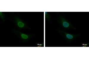 ICC/IF Image CNOT8 antibody detects CNOT8 protein at nucleus and cytoplasm by immunofluorescent analysis. (CNOT8 antibody)