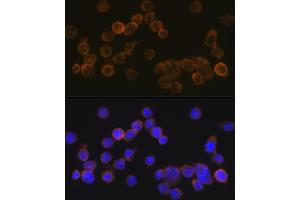 Immunofluorescence (IF) image for anti-Complement Component Receptor 1 (CD35) (CR1) antibody (ABIN7266477)