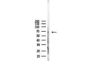 anti-Glycerol Phosphate Dehydrogenase 2, Mitochondrial (GPD2) (N-Term) antibody