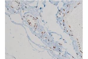 ABIN6267385 at 1/200 staining Human heart tissue sections by IHC-P. (Ezrin antibody  (pTyr478))
