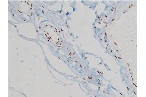 ABIN6267385 at 1/200 staining Human heart tissue sections by IHC-P.
