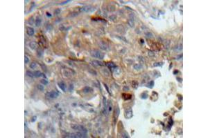 IHC-P analysis of Lung tissue, with DAB staining. (PKC theta antibody  (AA 380-634))