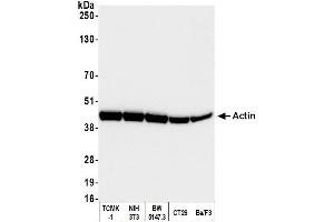 Western Blotting (WB) image for anti-Cytoskeletal Actin (CIMG_00972) (N-Term) antibody (ABIN7453904) (Cytoskeletal Actin (CIMG_00972) (N-Term) antibody)