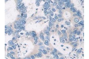 Immunohistochemistry (IHC) image for anti-Calcineurin (CAN) (AA 7-301) antibody (ABIN7433471)