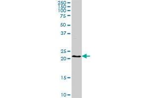 BST2 MaxPab rabbit polyclonal antibody. (BST2 antibody  (AA 40-180))