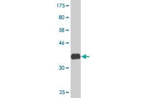 Western Blotting (WB) image for anti-ATP-Binding Cassette, Sub-Family C (CFTR/MRP), Member 5 (ABCC5) (AA 760-846) antibody (ABIN523432)