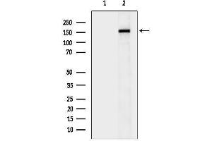 Western blot analysis of JD expression in human prostate cancer ,The lane on the left was treated with the antigen-specific peptide.