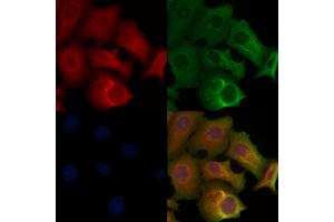 ABIN6260501 and ABIN6268729 staining Hela cells by IF/ICC.