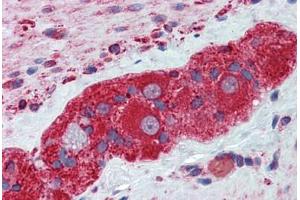 Human Small Intestine, Myenteric Plexus: Formalin-Fixed, Paraffin-Embedded (FFPE) (TUBB2A antibody  (AA 1-446))