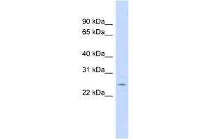 CRP antibody used at 1 ug/ml to detect target protein. (CRP antibody  (N-Term))