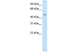 WB Suggested Anti-PTDSR Antibody Titration:  1. (JMJD6 antibody  (C-Term))