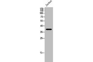 Western Blot analysis of Jurkat cells using Peropsin Polyclonal Antibody (Peropsin antibody  (Internal Region))