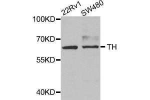Western blot analysis of extracts of 22Rv1 and SW480 cells, using TH antibody. (TH antibody)