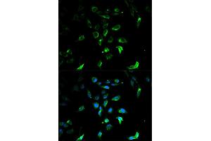 Immunofluorescence analysis of U2OS cells using STAR antibody. (STAR antibody)