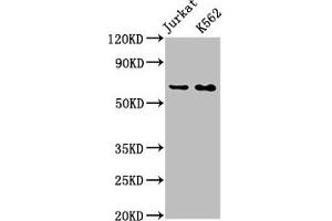 Western Blot Positive WB detected in: Jurkat whole cell lysate, K562 whole cell lysate All lanes: STIP1 antibody at 0. (Recombinant STIP1 antibody)
