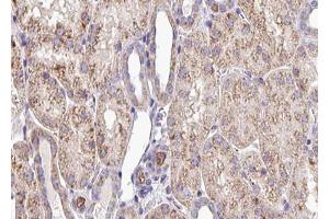 ABIN6272931 at 1/100 staining Mouse kidney tissue by IHC-P. (SQRDL antibody)