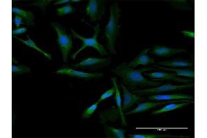 Immunofluorescence of purified MaxPab antibody to RARS2 on HeLa cell. (RARS2 antibody  (AA 1-578))