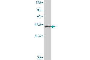 Western Blot detection against Immunogen (39. (Tuberin antibody  (AA 540-658))