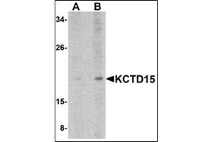 Western blot analysis of KCTD15 in human spleen tissue lysate with this product at (A) 0. (KCTD15 antibody  (C-Term))