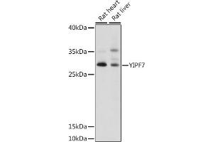 Western blot analysis of extracts of various cell lines, using YIPF7 antibody (ABIN7271420) at 1:1000 dilution.