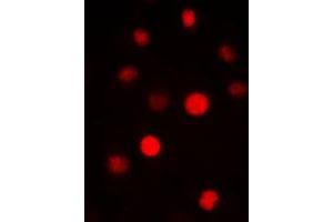 Immunofluorescent analysis of SAP14 staining in HepG2 cells. (Pre-mRNA Branch Site Protein p14 (SF3B14) (C-Term) antibody)