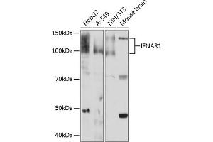 Western blot analysis of extracts of various cell lines, using IFN Rabbit mAb (ABIN1682980, ABIN3015227, ABIN3015228 and ABIN7101324) at 1:1000 dilution. (IFNAR1 antibody)