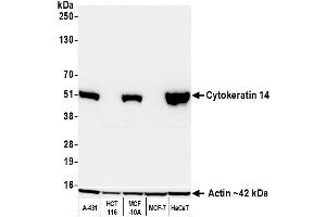 anti-Keratin 14 (KRT14) (C-Term) antibody