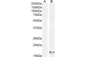 Western Blot using anti-IL-18 antibody SAIC-24B-4. (Recombinant IL-18 antibody)