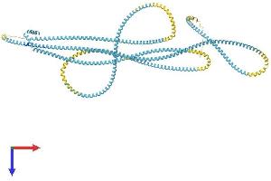 Myosin, Heavy Chain 16 Pseudogene (MYH16) (AA 1-1097) protein (His tag)