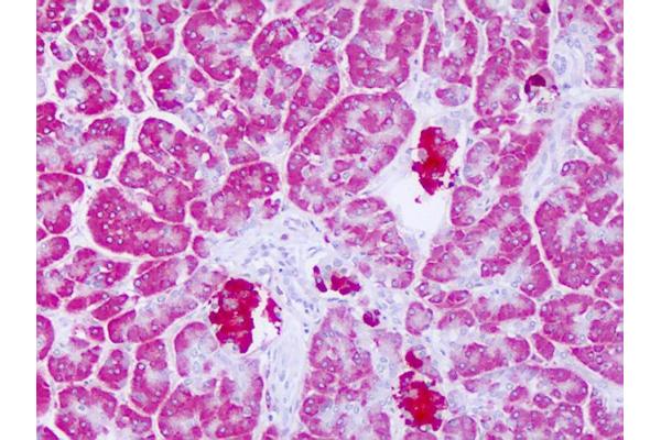 LYPLAL1 antibody  (C-Term)