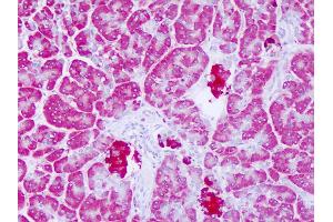 Anti-LYPLAL1 antibody IHC of human pancreas. (LYPLAL1 antibody  (C-Term))