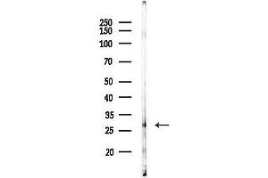 anti-Cathepsin G (CTSG) (Internal Region) antibody