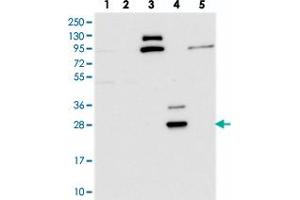 Western blot analysis of Lane 1: RT-4, Lane 2: U-251 MG, Lane 3: Human Plasma, Lane 4: Liver, Lane 5: Tonsil with CYB561D2 polyclonal antibody . (CYB561D2 antibody)