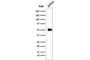 Western Blot Analysis of Jurkat cell lysate using CD2 Mouse Monoclonal Antibody (1E7E8. (CD2 antibody)