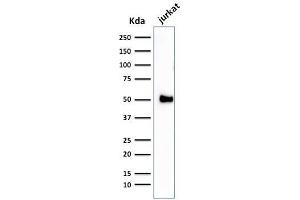 Western Blot Analysis of Jurkat cell lysate using CD2 Mouse Monoclonal Antibody (1E7E8. (CD2 antibody)