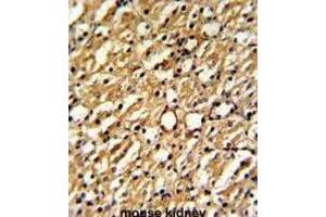 Immunohistochemistry (IHC) image for anti-Dimethylarginine Dimethylaminohydrolase 1 (DDAH1) antibody (ABIN3001702) (DDAH1 antibody)