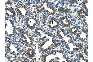 RPL8 antibody was used for immunohistochemistry at a concentration of 4-8 ug/ml to stain Alveolar cells (arrows) in Human Lung.