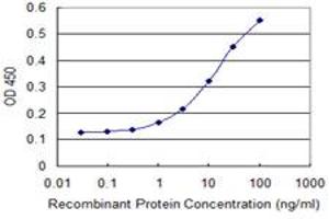 Detection limit for recombinant GST tagged AIP is 0. (AIP antibody  (AA 156-249))
