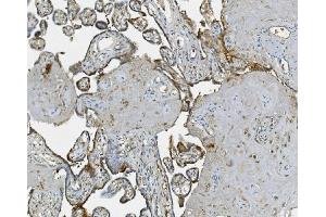 IHC analysis of RAB1B using anti-RAB1B antibody (ABIN7602809). (RAB1B antibody  (C-Term))