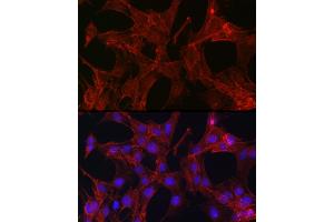 Immunofluorescence analysis of C6 cells using Gelsolin Rabbit pAb (ABIN7267365) at dilution of 1:50 (40x lens).