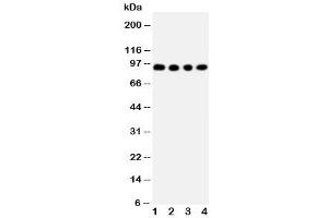 Western blot testing of ADAM17 antibody and Lane 1:  human placenta (ADAM17 antibody  (C-Term))