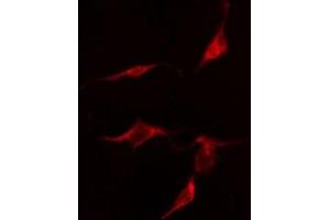 ABIN6275848 staining  HepG2 cells by IF/ICC. (MASTL antibody  (C-Term))