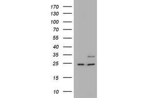 Image no. 1 for anti-RAB21, Member RAS Oncogene Family (RAB21) antibody (ABIN1500549) (RAB21 antibody)