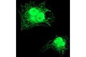 Anti-GDAP1L1 mouse monoclonal antibody (ABIN2454765) immunofluorescent staining of COS7 cells transiently transfected by pCMV6-ENTRY GDAP1L1 (RC200976). (GDAP1L1 antibody)