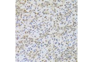 Immunohistochemistry of paraffin-embedded mouse lung using HMGB1 Antibody. (HMGB1 antibody  (AA 100-200))