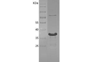 Western Blotting (WB) image for YY1 Transcription Factor (YY1) (AA 35-146) protein (His tag) (ABIN7281631) (YY1 Protein (AA 35-146) (His tag))