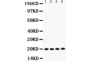 Western Blotting (WB) image for anti-Parkinson Protein 7 (PARK7) (AA 2-189) antibody (ABIN3043589) (PARK7/DJ1 antibody  (AA 2-189))