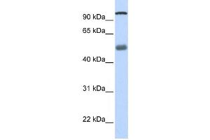 Western Blotting (WB) image for anti-DEAH (Asp-Glu-Ala-His) Box Polypeptide 32 (DHX32) antibody (ABIN2458244) (DHX32 antibody)