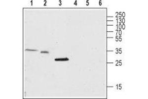Western blot analysis of rat brain lysate (lanes 1 and 4), and mouse brain membrane (lanes 2 and 5) and skeletal muscle (lanes 3 and 6): - 1-3. (TMEM38A antibody  (C-Term, Intracellular))